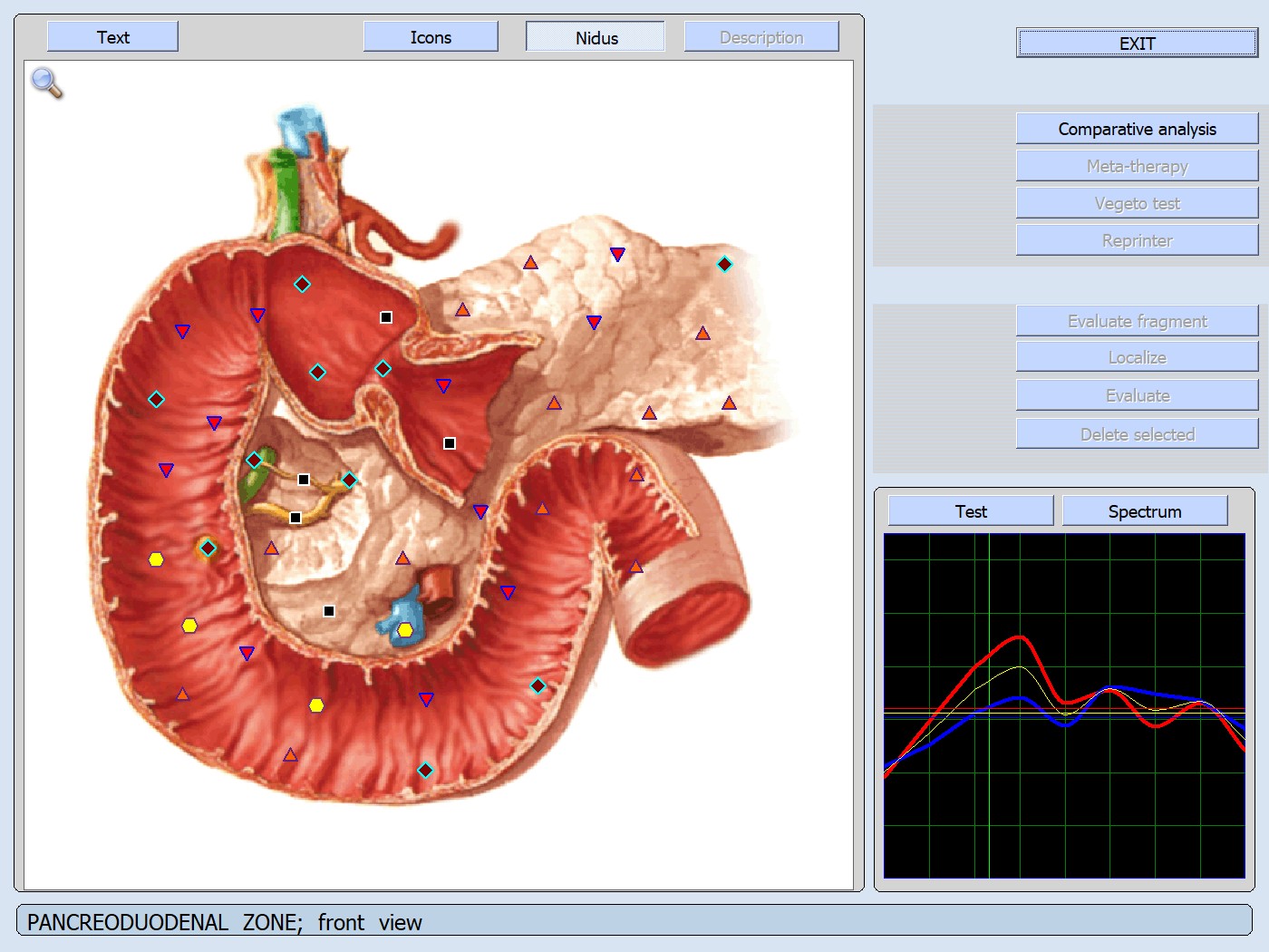 Pancreas zona duodenale