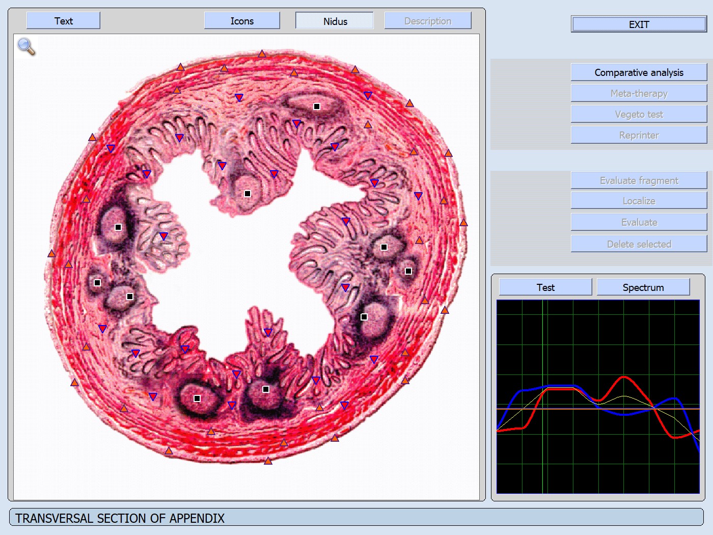 Parete Appendix