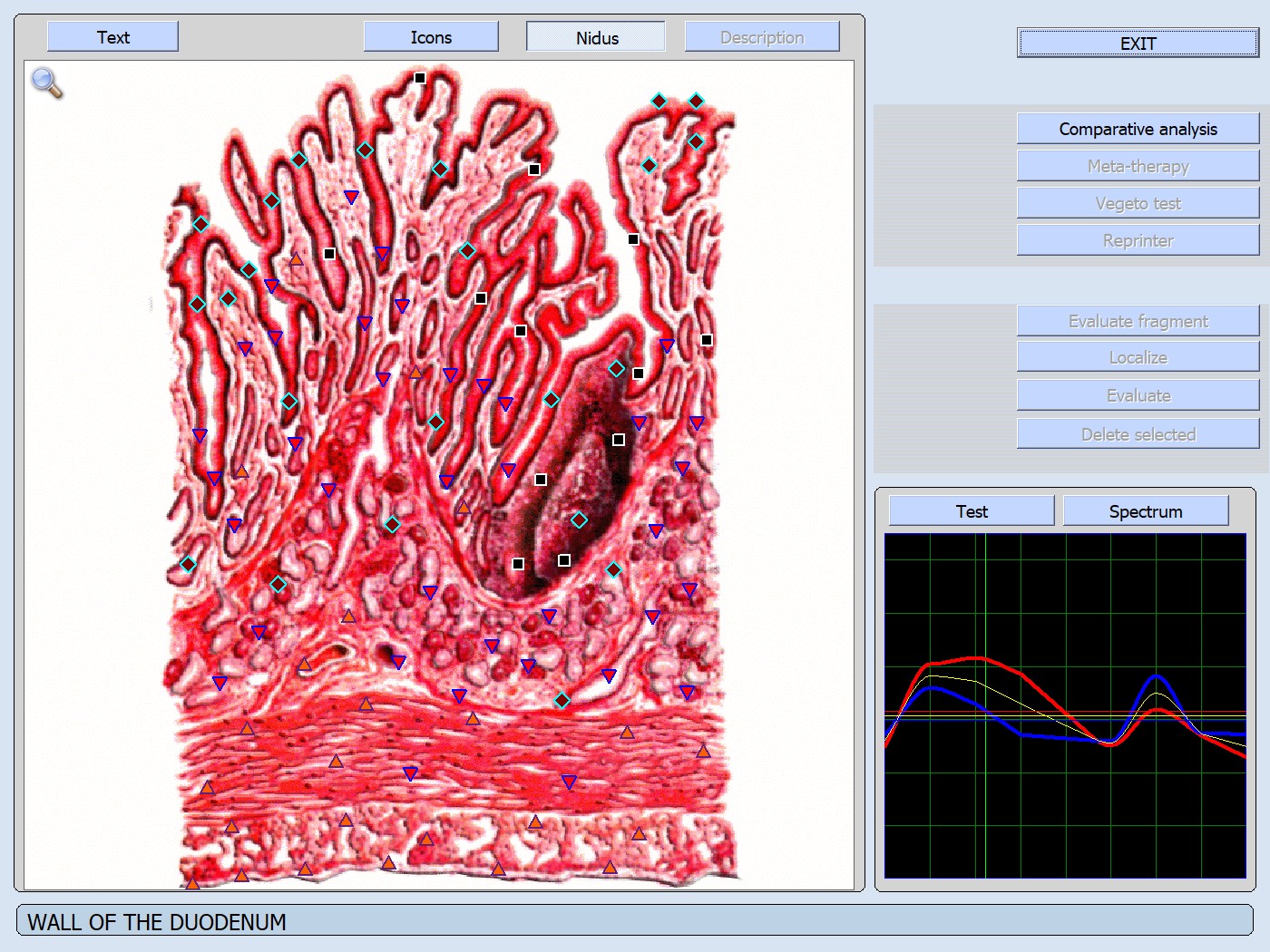 Wall duodenum