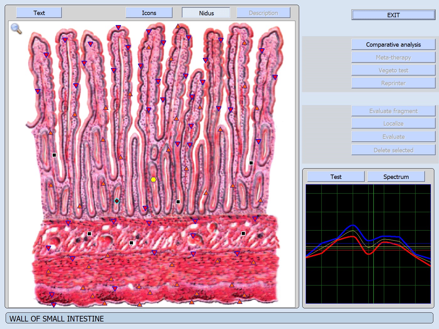 Wal small intestine